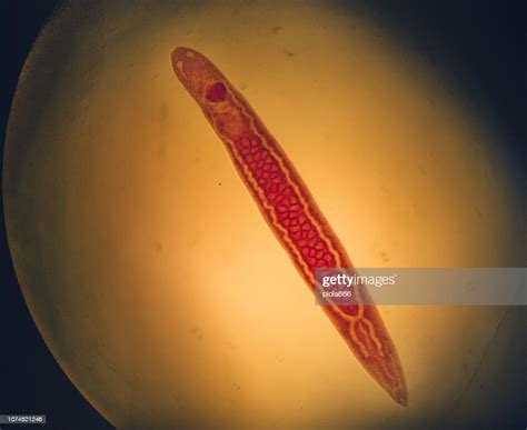 Eyephlid Trematode: A Master of Deception Lurking Beneath the Surface!  This parasitic flatworm possesses an intricate life cycle that involves multiple hosts and a remarkable ability to manipulate its environment for survival.