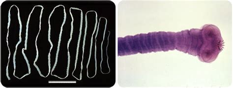  Tapeworm! A Parasitic Flatworm That Thrives Within the Intestines of its Unlucky Hosts