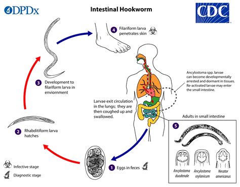 Uroscopidae:  A Tiny Parasite Causing Mayhem With Its Microscopic Lifecycle!