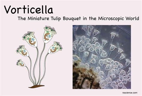 Vorticella! A Microscopic Marvel Combining Elegant Locomotion with Voracious Predatory Instincts